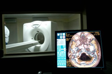 Hastanede MRI Tarayıcı Ekipmanı