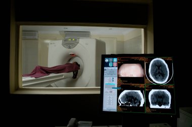 Hastanede MRI Tarayıcı Ekipmanı
