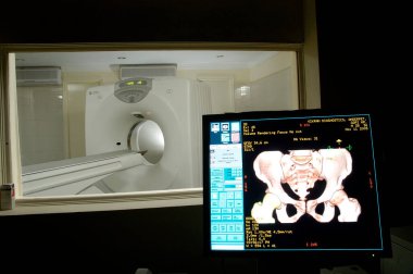 Hastanede MRI Tarayıcı Ekipmanı