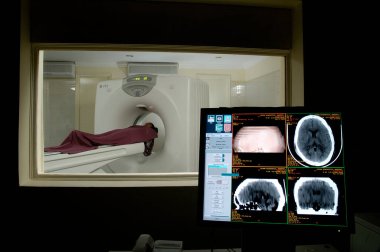 Hastanede MRI Tarayıcı Ekipmanı