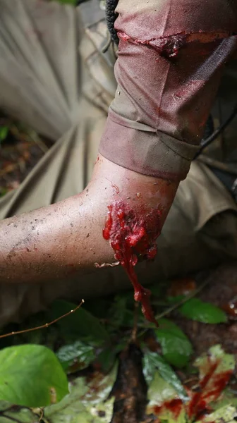 Indian Police with wound on body