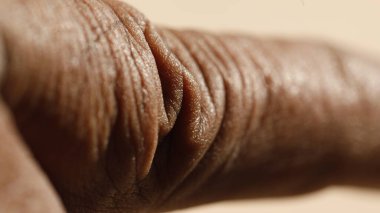 İnsan Derisinin Macro Çekimi