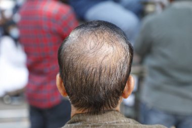 Rear view of Bald head man clipart