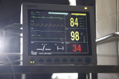 Yoğun bakımda EKG monitörü