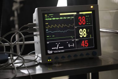Yoğun bakımda EKG monitörü