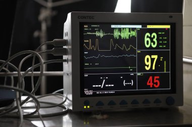 Yoğun bakımda EKG monitörü