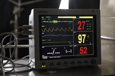 Yoğun bakımda EKG monitörü