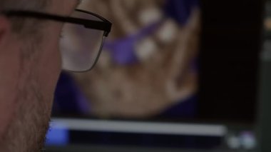 Doktor x-ray bulanık ışık ekranını inceliyor.. 