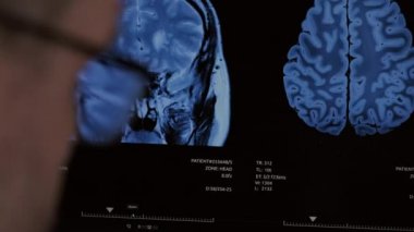 Hastane ofisinde röntgen analizi yapan bir doktor..