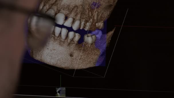 Close-up view Doctor onderzoekt x-ray wazig licht scherm. — Stockvideo