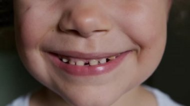 Close up view of babys tooth is ready to fall out. High quality 4k footage