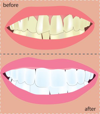 Kozmetik Diş Hekimi