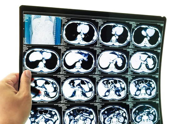 Medische diagnose achtergrond. CT-scan en hand — Stockfoto