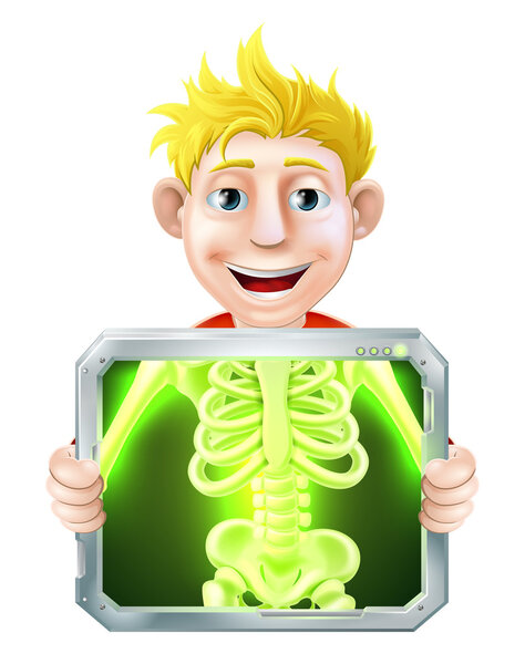 X-Ray Illustration