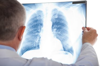 Kıdemli doktor akciğer Radyografi incelenmesi