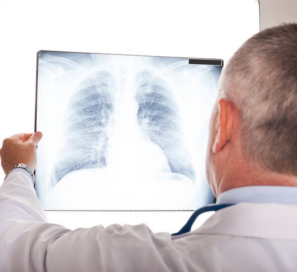 Doctor looking at a radiography