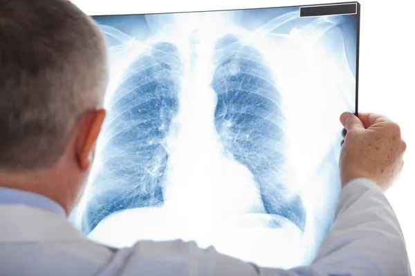 Médico sênior examinando uma radiografia pulmonar Imagens De Bancos De Imagens