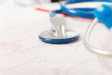 stetoskop bir Elektrokardiyogram üzerine