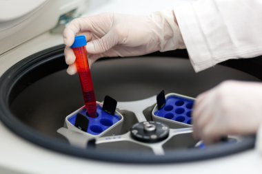 Elektronik kan santrifüj ile çalışan doktor