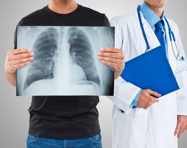 Hombre sosteniendo una radiografía de sus pulmones — Foto de Stock