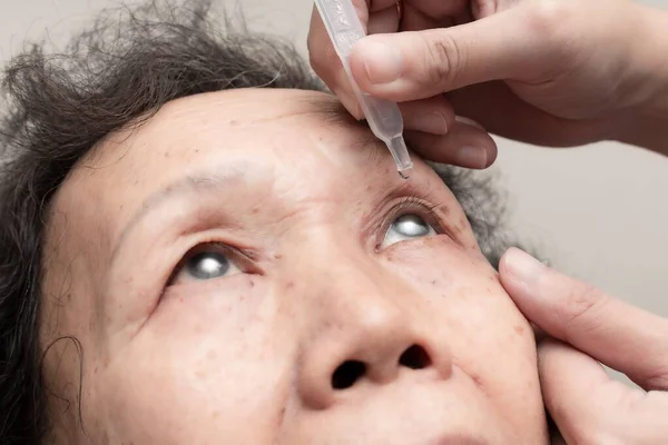 Close up of elder woman drips eye drops into her eyes. Treatment for eye diseases. Healthcare concept — Stock fotografie