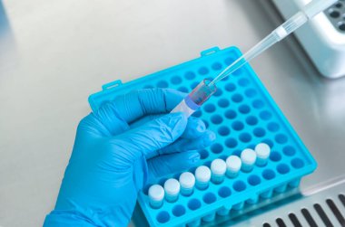 Laboratuvarda kan örneğiyle çalışan bilim adamı. Yeni hızla yayılan Corona virüsü salgını için bir kan testi sonucu. Coronavirus aşısı geliştirme.