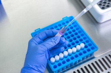 Bir laboratuvar teknisyeninin ellerinde bir tüp kan örneği ve diğer numunelerle dolu bir raf var. Üzerinde çalışmak için kan tüpü örneği tutan laboratuvar teknisyeni. Corona virüsü salgını konsepti. Coronavirus aşısı gelişimi.