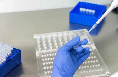 Bir laboratuvar teknisyeninin ellerinde bir tüp kan örneği ve diğer numunelerle dolu bir raf var. Üzerinde çalışmak için kan tüpü örneği tutan laboratuvar teknisyeni. Corona virüsü salgını konsepti. Coronavirus aşısı gelişimi.