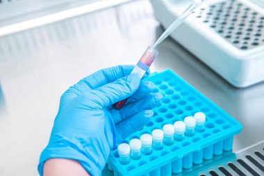 Bir laboratuvar teknisyeninin ellerinde bir tüp kan örneği ve diğer numunelerle dolu bir raf var. Üzerinde çalışmak için kan tüpü örneği tutan laboratuvar teknisyeni. Corona virüsü salgını konsepti. Coronavirus aşısı gelişimi.