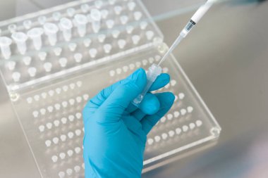 Araştırma laboratuvarında kan tüpü testi yapan doktor. Corona virüsü salgını aşısı geliştirme konsepti.