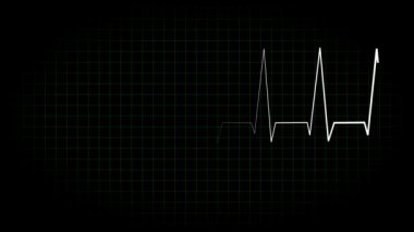 Elektrokardiyogram osiloskop dalga formu animasyon hareketi grafikleri