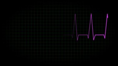 Elektrokardiyogram osiloskop dalga formu animasyon hareketi grafikleri