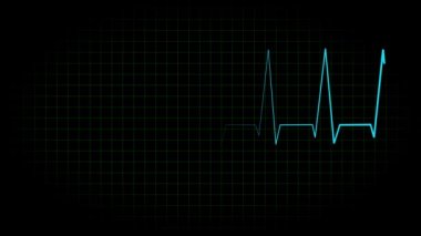 Elektrokardiyogram osiloskop dalga formu animasyon hareketi grafikleri