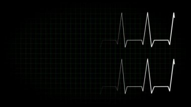 Elektrokardiyogram osiloskop dalga formu animasyon hareketi grafikleri