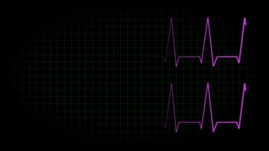 Elektrokardiyogram osiloskop dalga formu animasyon hareketi grafikleri