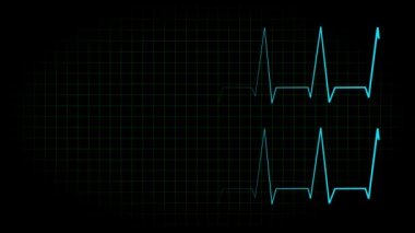 Elektrokardiyogram osiloskop dalga formu animasyon hareketi grafikleri
