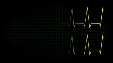 Elektrokardiyogram osiloskop dalga formu animasyon hareketi grafikleri