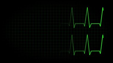 Elektrokardiyogram osiloskop dalga formu animasyon hareketi grafikleri