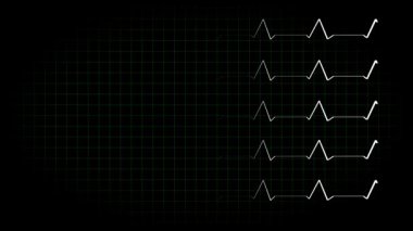 Elektrokardiyogram osiloskop dalga formu animasyon hareketi grafikleri