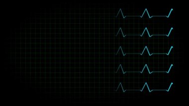 Elektrokardiyogram osiloskop dalga formu animasyon hareketi grafikleri
