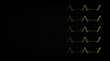 Elektrokardiyogram osiloskop dalga formu animasyon hareketi grafikleri
