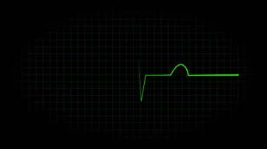 Elektrokardiyogram osiloskop dalga formu animasyon hareketi grafikleri