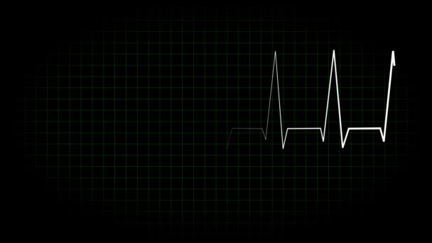 Elektrocardiogram Oscilloscoop Golfvorm Animatie Beweging Graphics — Stockvideo