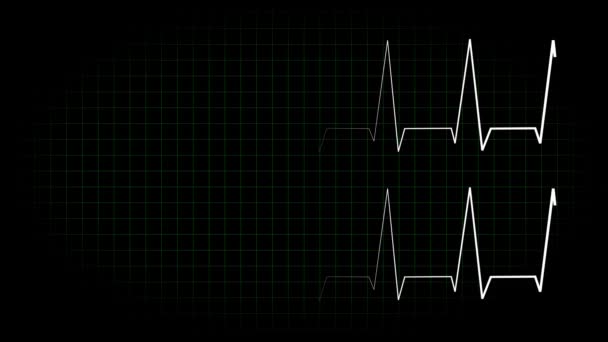 Elektrokardiogram Oscilloskop Vågform Animation Rörelse Grafik — Stockvideo