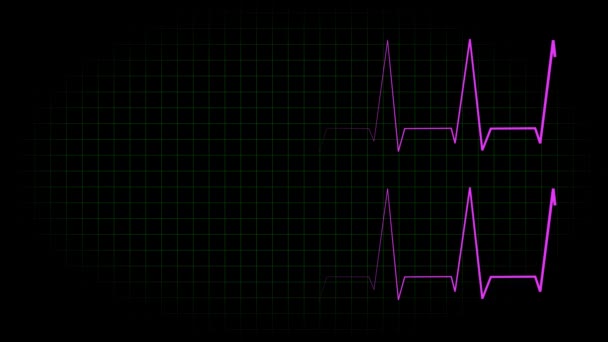 Elektrokardiyogram Osiloskop Dalga Formu Animasyon Hareketi Grafikleri — Stok video