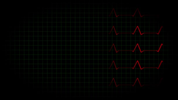 Eletrocardiograma Osciloscópio Forma Onda Animação Movimento Gráficos — Vídeo de Stock