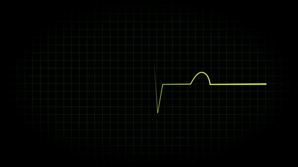 Eletrocardiograma Osciloscópio Forma Onda Animação Movimento Gráficos — Vídeo de Stock