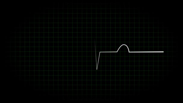 Elektrokardiogram Oscyloskop Fali Animacji Animacji Ruchu Grafiki — Wideo stockowe