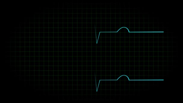 Osciloscopio Electrocardiograma Animación Forma Onda Gráficos Movimiento — Vídeo de stock