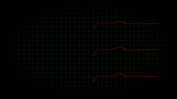 心電図オシロスコープ波形アニメーションモーショングラフィックス — ストック動画